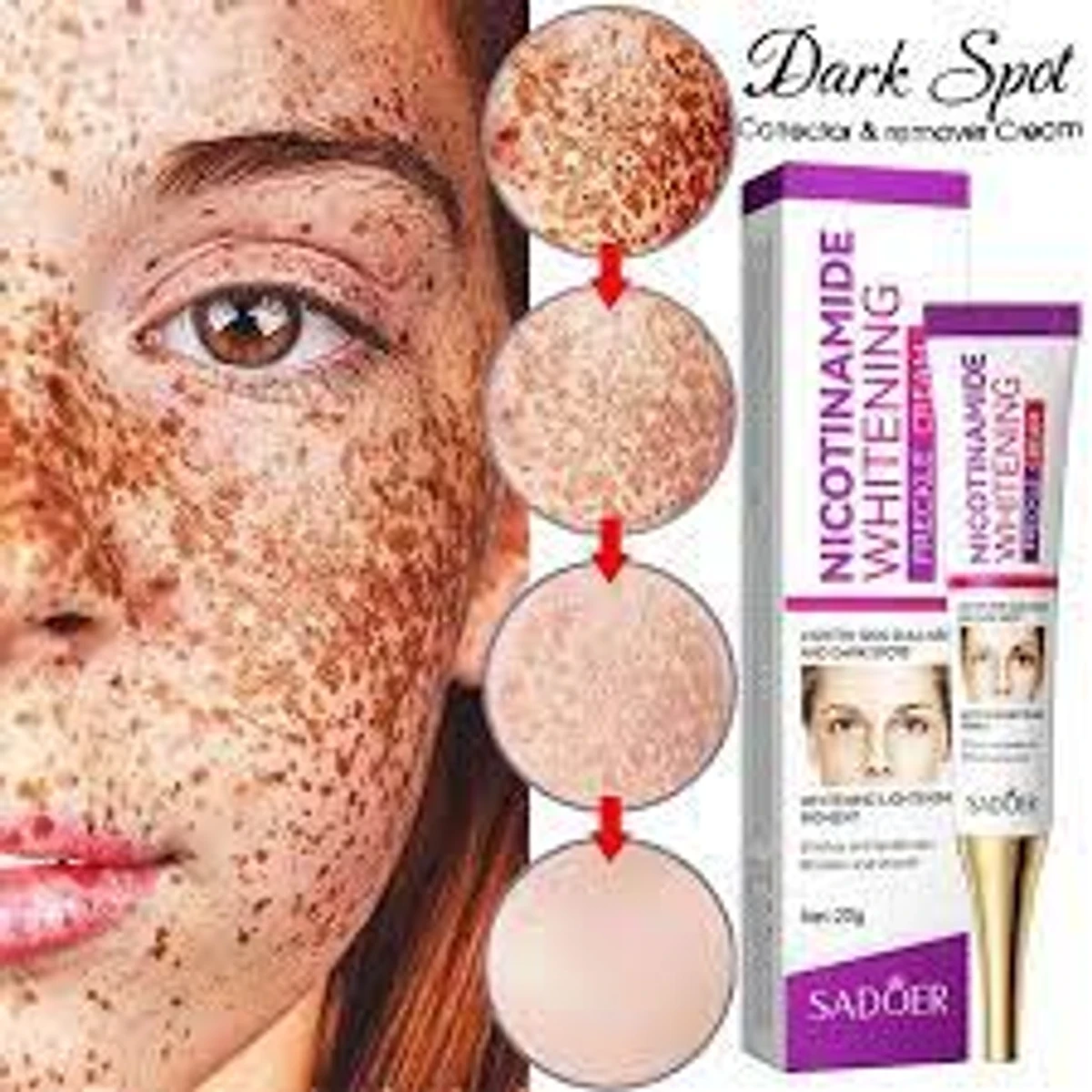 Freckle Removal Cream Moisturizing Moisturizing